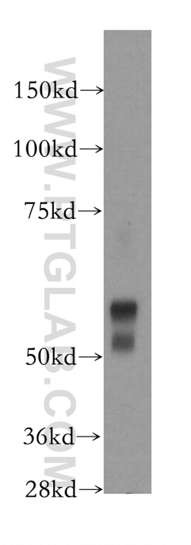 FBXO7 Antibody in Western Blot (WB)