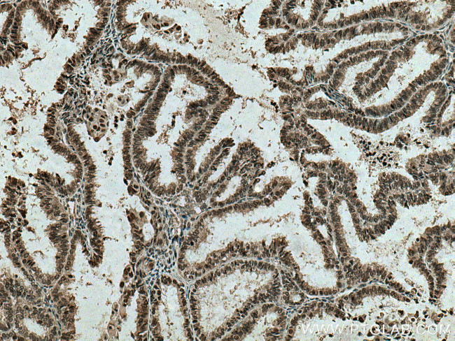 RCC1 Antibody in Immunohistochemistry (Paraffin) (IHC (P))