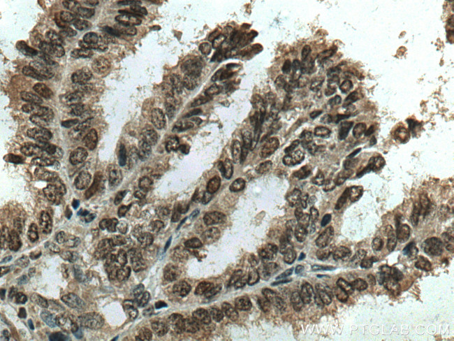 RCC1 Antibody in Immunohistochemistry (Paraffin) (IHC (P))