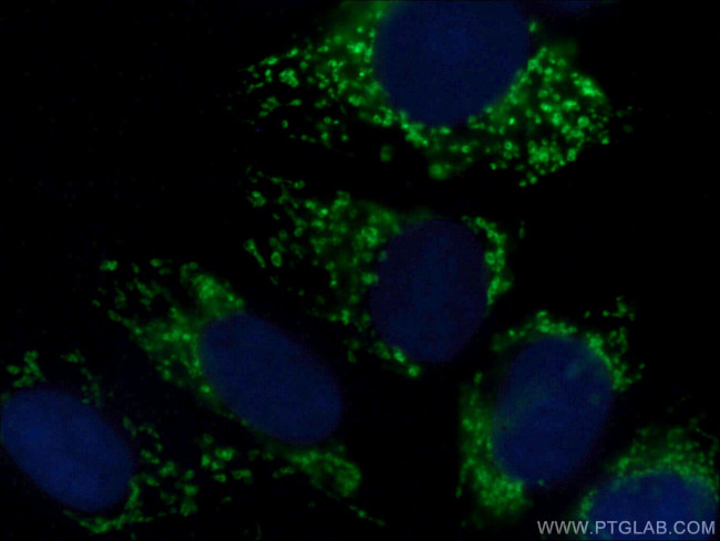 KMO Antibody in Immunocytochemistry (ICC/IF)