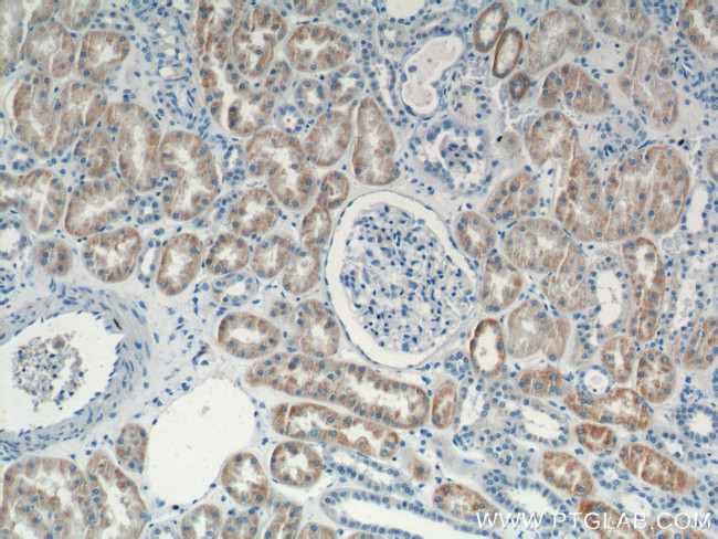 KMO Antibody in Immunohistochemistry (Paraffin) (IHC (P))