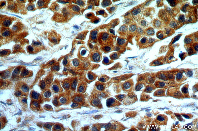 KMO Antibody in Immunohistochemistry (Paraffin) (IHC (P))