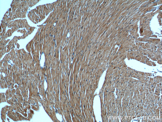 KMO Antibody in Immunohistochemistry (Paraffin) (IHC (P))