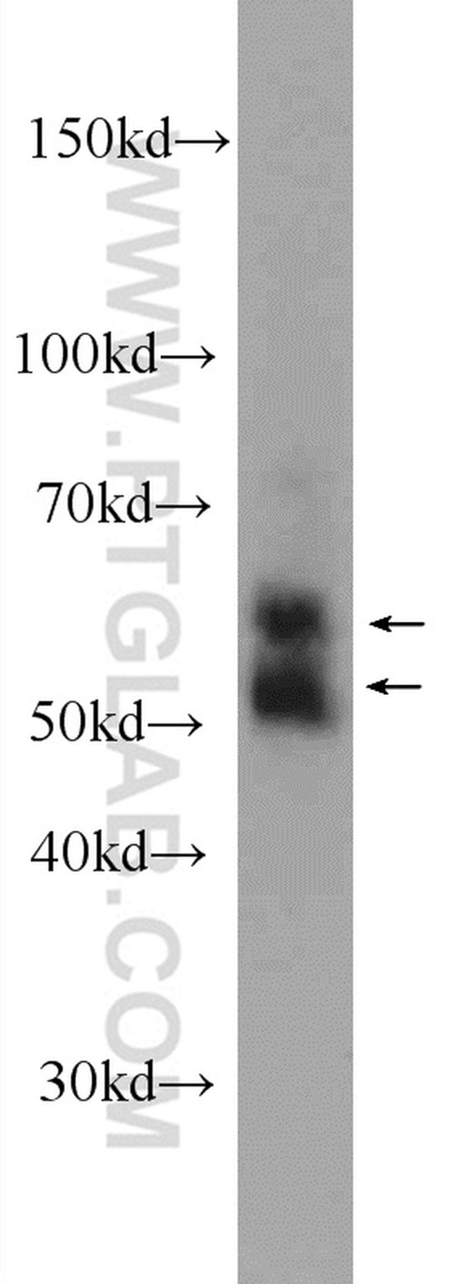 KMO Antibody in Western Blot (WB)