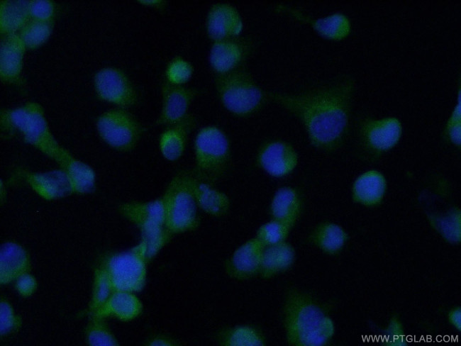 HO-1/HMOX1 Antibody in Immunocytochemistry (ICC/IF)