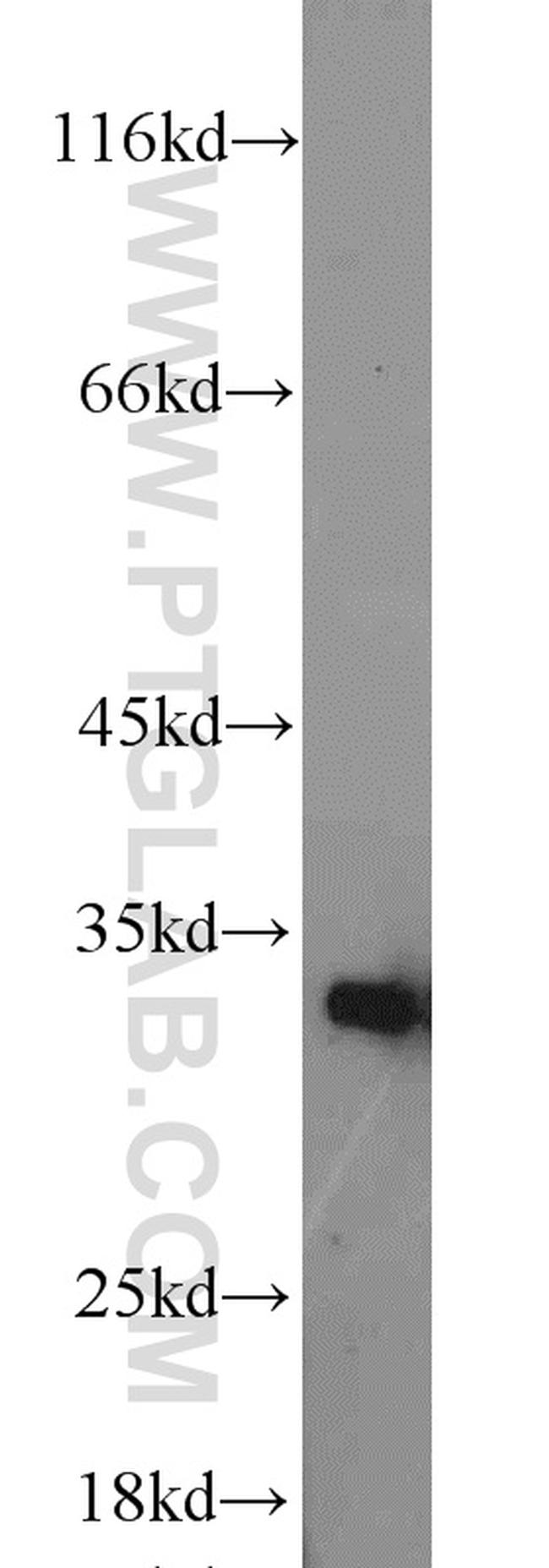 HO-1/HMOX1 Antibody in Western Blot (WB)