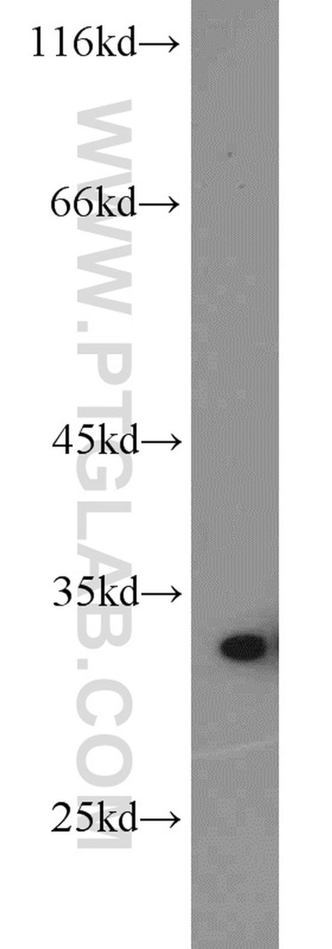 HO-1/HMOX1 Antibody in Western Blot (WB)