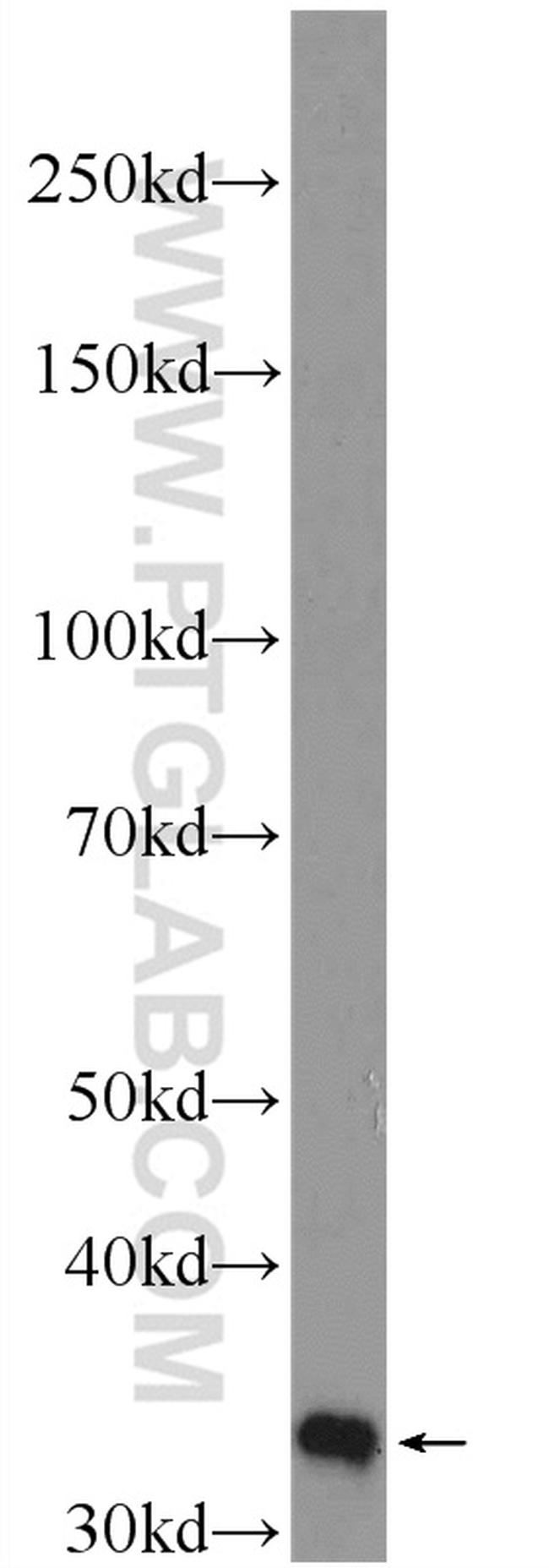 HO-1/HMOX1 Antibody in Western Blot (WB)