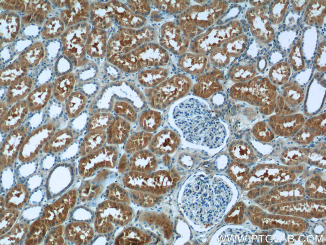 VAMP3/Cellubrevin Antibody in Immunohistochemistry (Paraffin) (IHC (P))