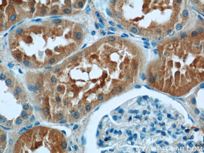 VAMP3/Cellubrevin Antibody in Immunohistochemistry (Paraffin) (IHC (P))