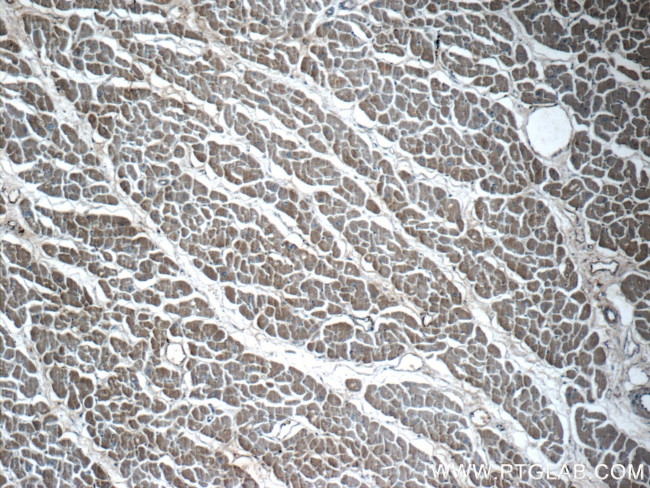 VAMP3/Cellubrevin Antibody in Immunohistochemistry (Paraffin) (IHC (P))