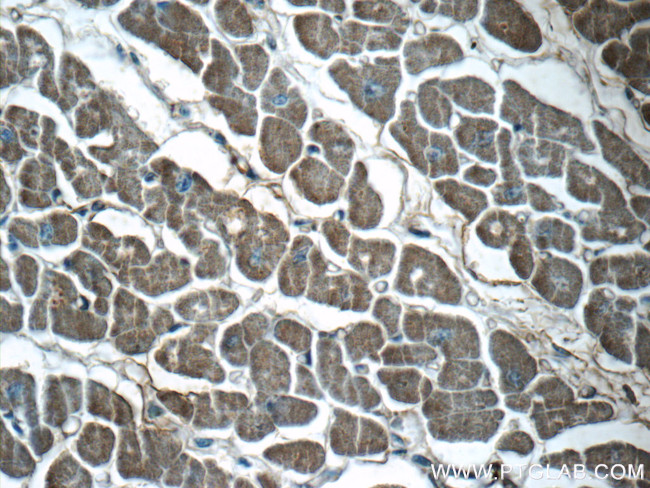 VAMP3/Cellubrevin Antibody in Immunohistochemistry (Paraffin) (IHC (P))