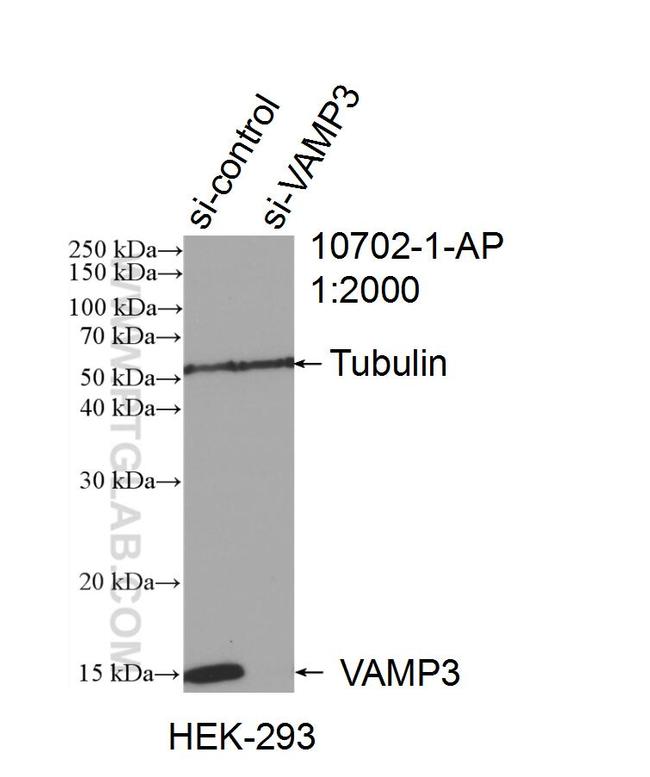 VAMP3/Cellubrevin Antibody in Western Blot (WB)