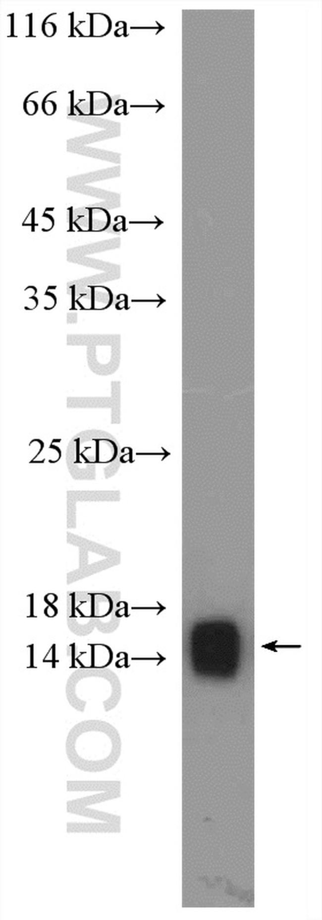 VAMP3/Cellubrevin Antibody in Western Blot (WB)