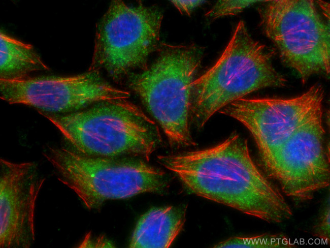 PRDX4 Antibody in Immunocytochemistry (ICC/IF)