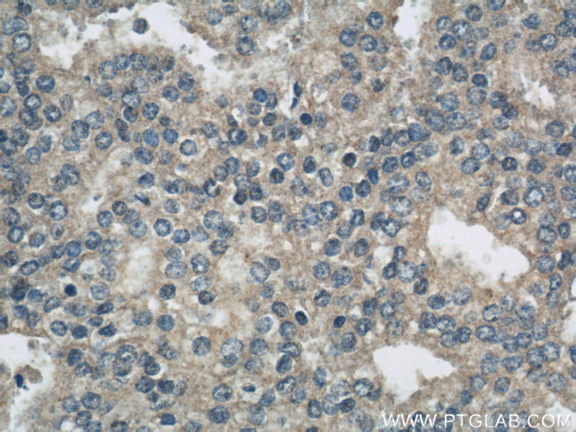 PRDX4 Antibody in Immunohistochemistry (Paraffin) (IHC (P))