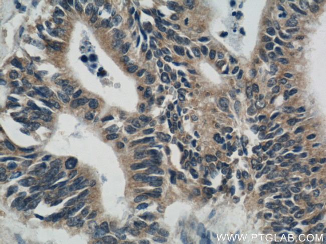 PRDX4 Antibody in Immunohistochemistry (Paraffin) (IHC (P))