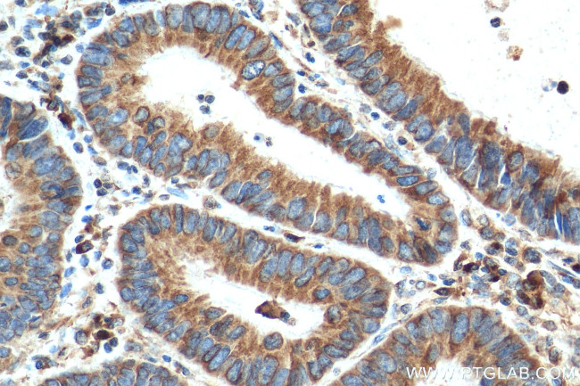 PRDX4 Antibody in Immunohistochemistry (Paraffin) (IHC (P))