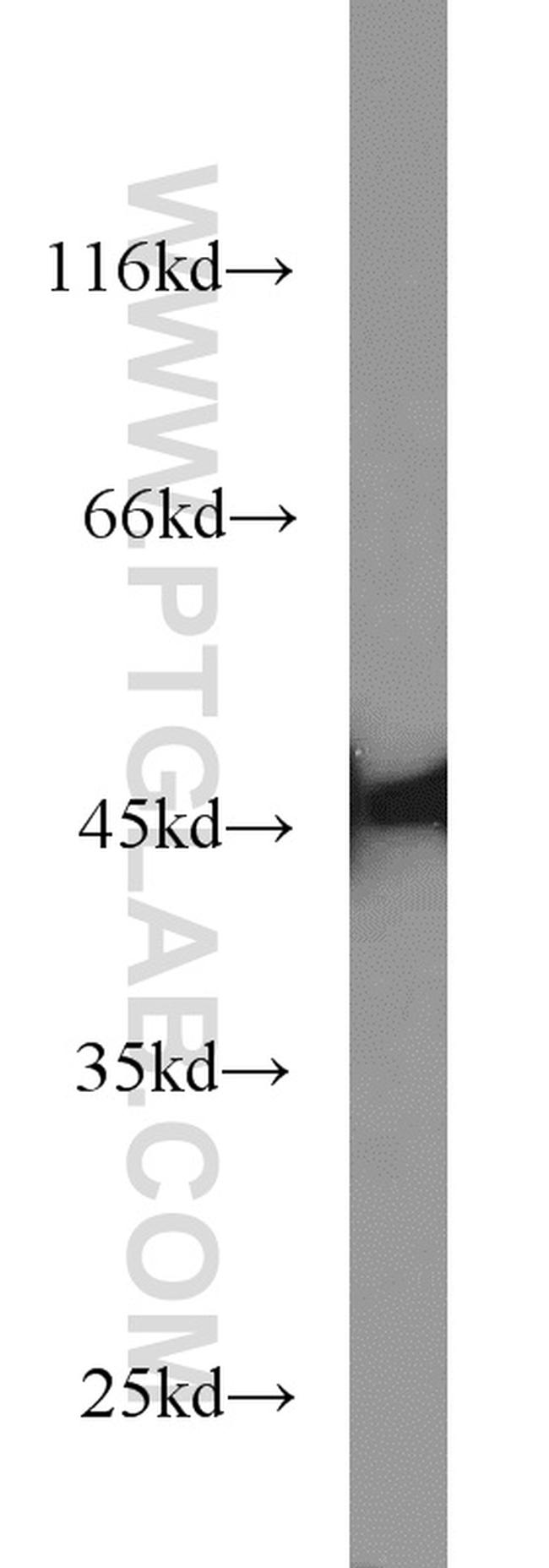 NELFE Antibody in Western Blot (WB)