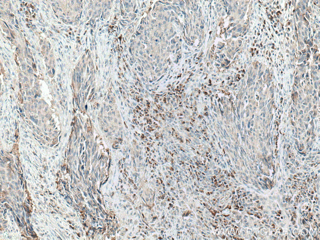 CXCL11 Antibody in Immunohistochemistry (Paraffin) (IHC (P))