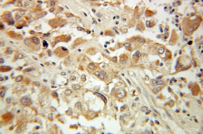 SAT1 Antibody in Immunohistochemistry (Paraffin) (IHC (P))