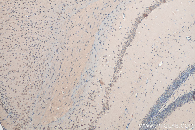 SAT1 Antibody in Immunohistochemistry (Paraffin) (IHC (P))