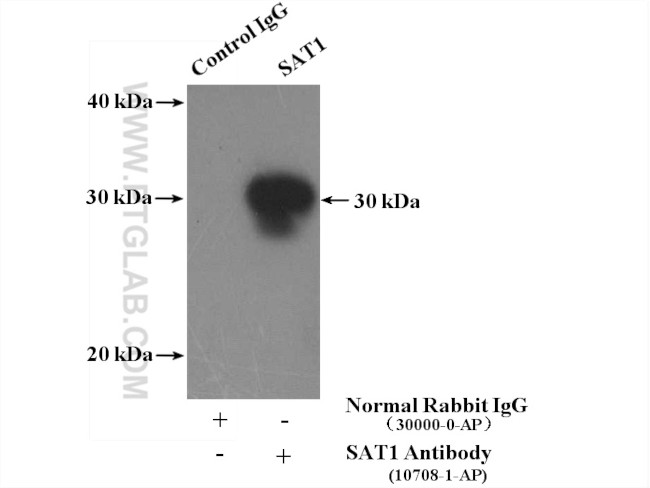SAT1 Antibody in Immunoprecipitation (IP)