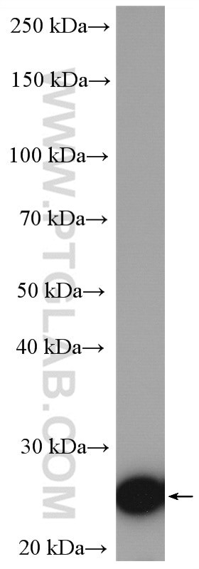 SAT1 Antibody in Western Blot (WB)