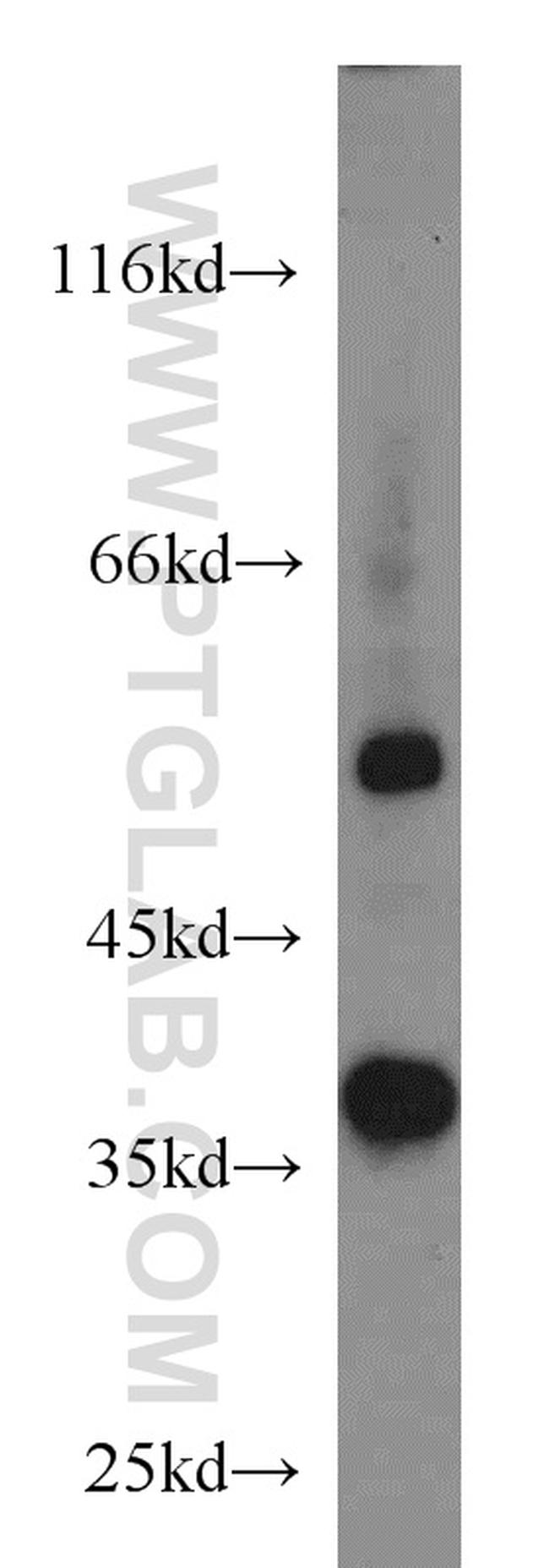 SIX1 Antibody in Western Blot (WB)