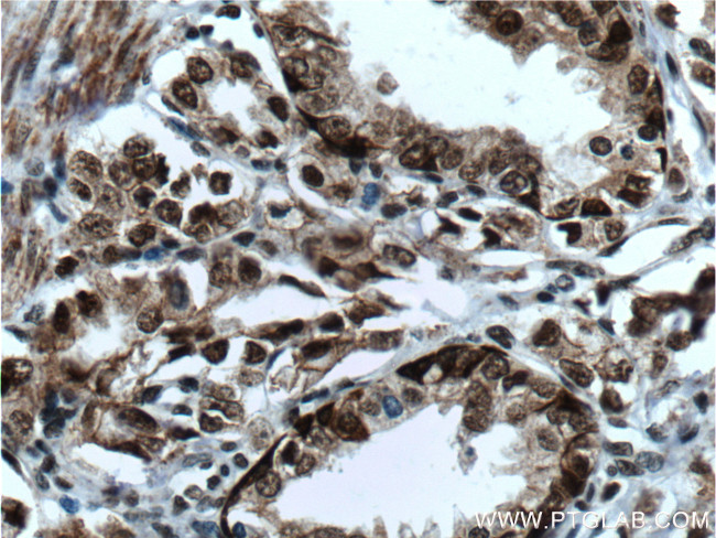 C1D Antibody in Immunohistochemistry (Paraffin) (IHC (P))