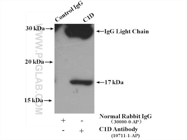 C1D Antibody in Immunoprecipitation (IP)