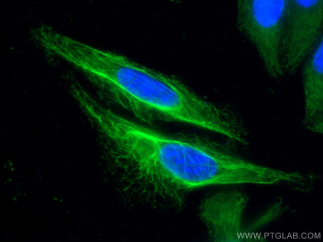 Cytokeratin 19 Antibody in Immunocytochemistry (ICC/IF)