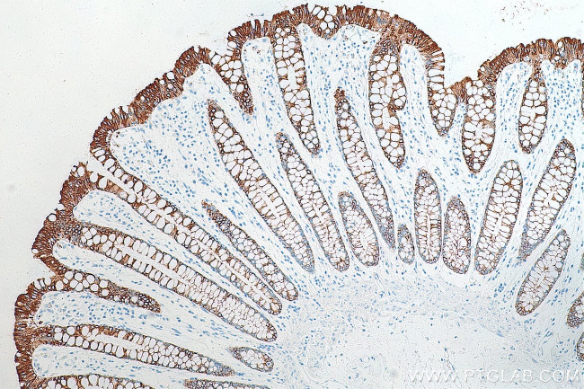 Cytokeratin 19 Antibody in Immunohistochemistry (Paraffin) (IHC (P))