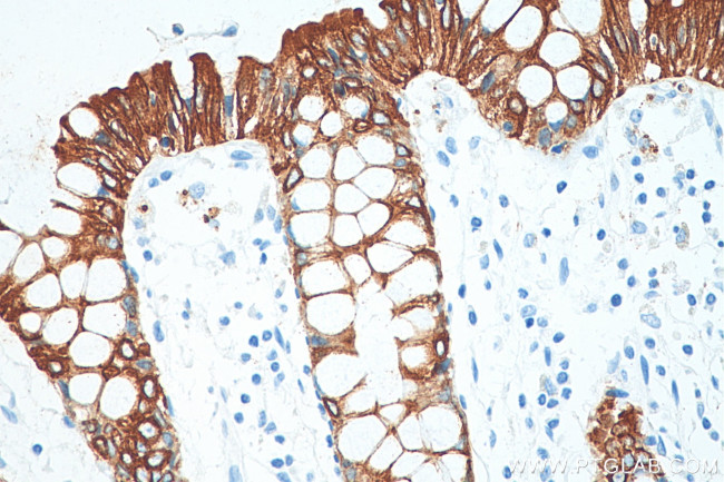 Cytokeratin 19 Antibody in Immunohistochemistry (Paraffin) (IHC (P))