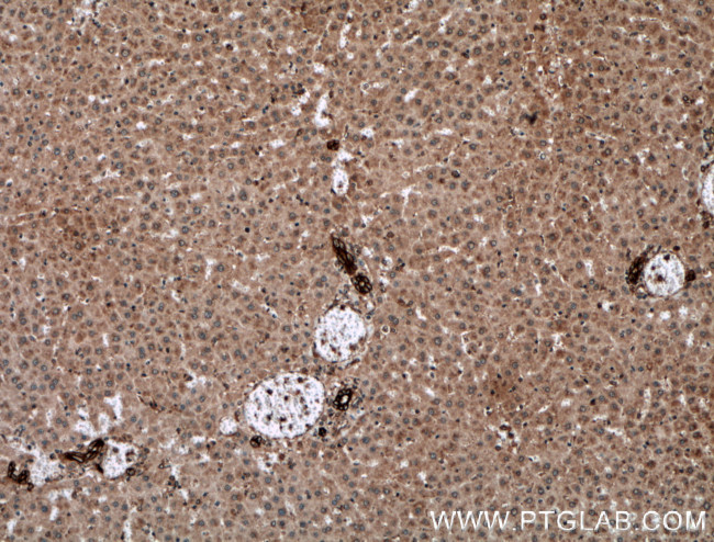 Cytokeratin 19 Antibody in Immunohistochemistry (Paraffin) (IHC (P))