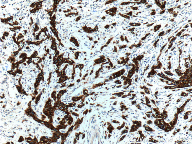 Cytokeratin 19 Antibody in Immunohistochemistry (Paraffin) (IHC (P))