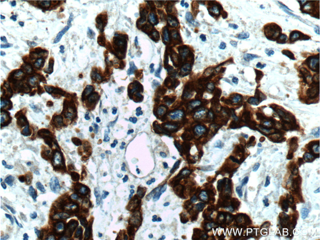 Cytokeratin 19 Antibody in Immunohistochemistry (Paraffin) (IHC (P))