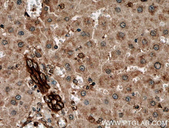 Cytokeratin 19 Antibody in Immunohistochemistry (Paraffin) (IHC (P))