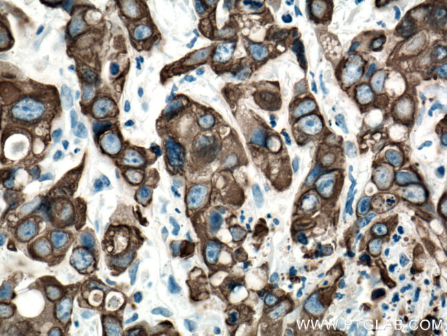 Cytokeratin 19 Antibody in Immunohistochemistry (Paraffin) (IHC (P))