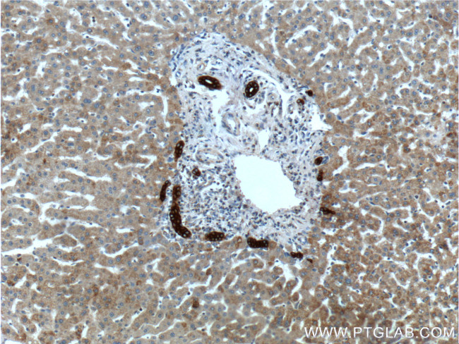 Cytokeratin 19 Antibody in Immunohistochemistry (Paraffin) (IHC (P))