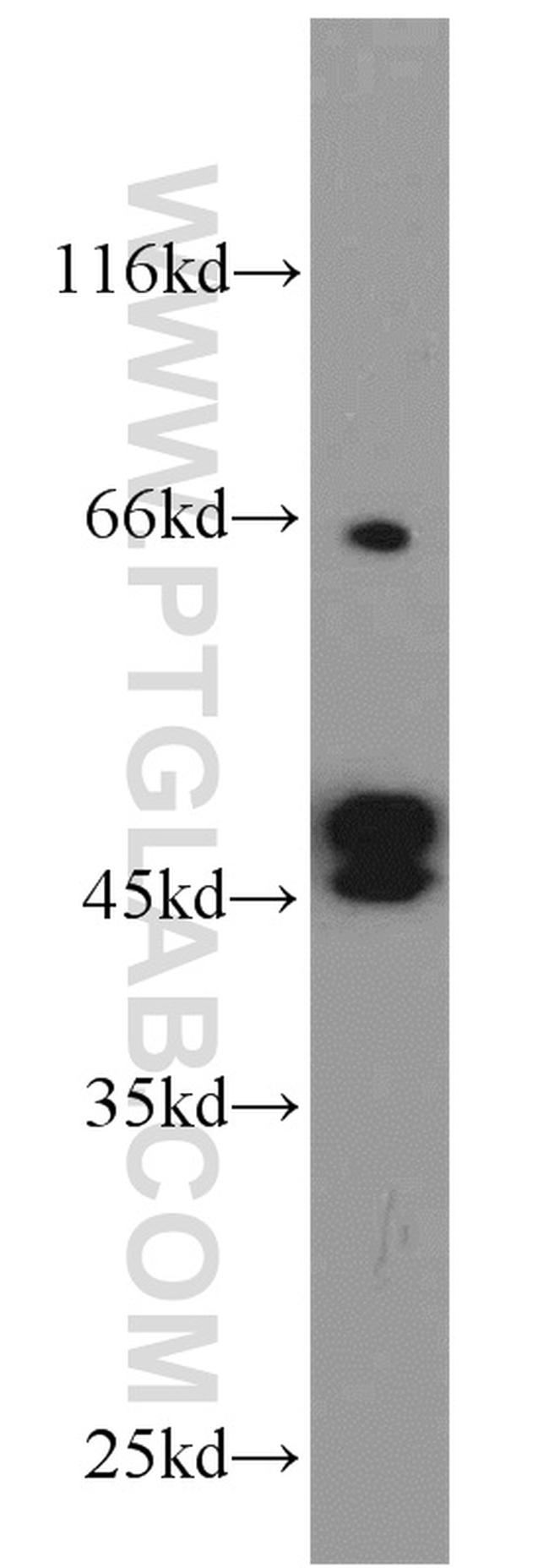 Cytokeratin 19 Antibody in Western Blot (WB)