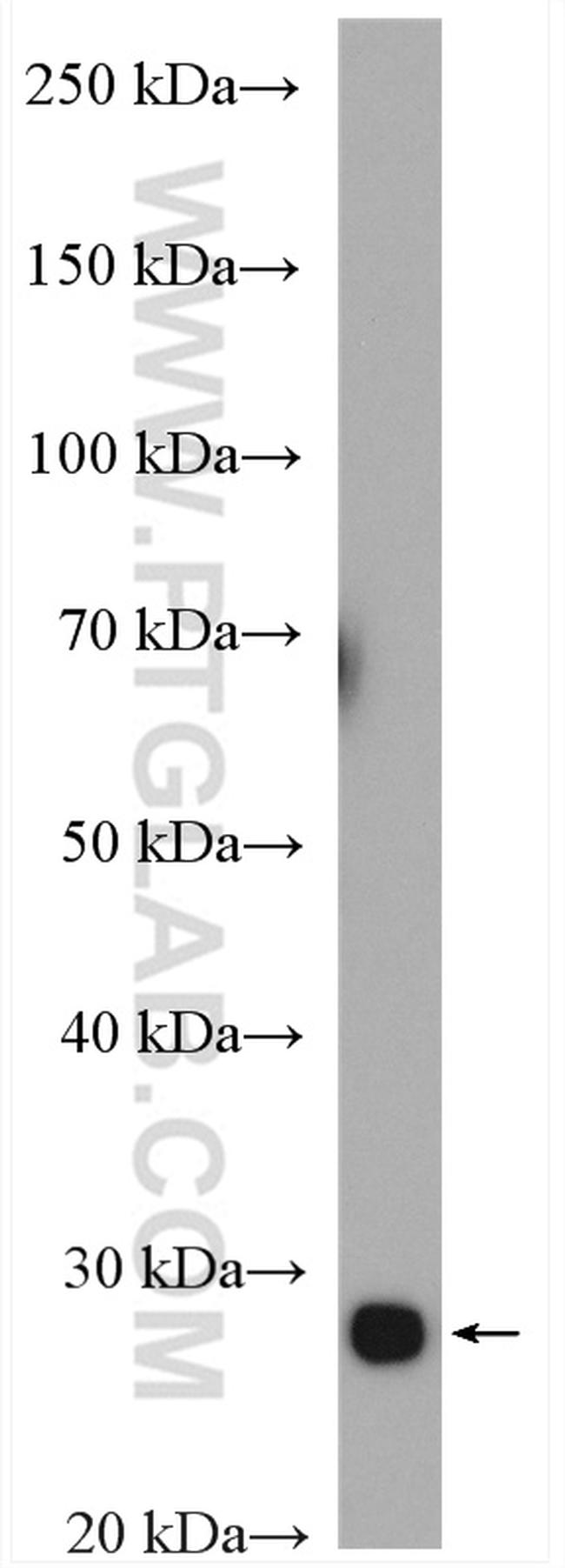 TPI1 Antibody in Western Blot (WB)