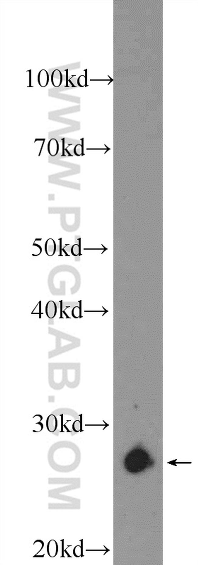 TPI1 Antibody in Western Blot (WB)