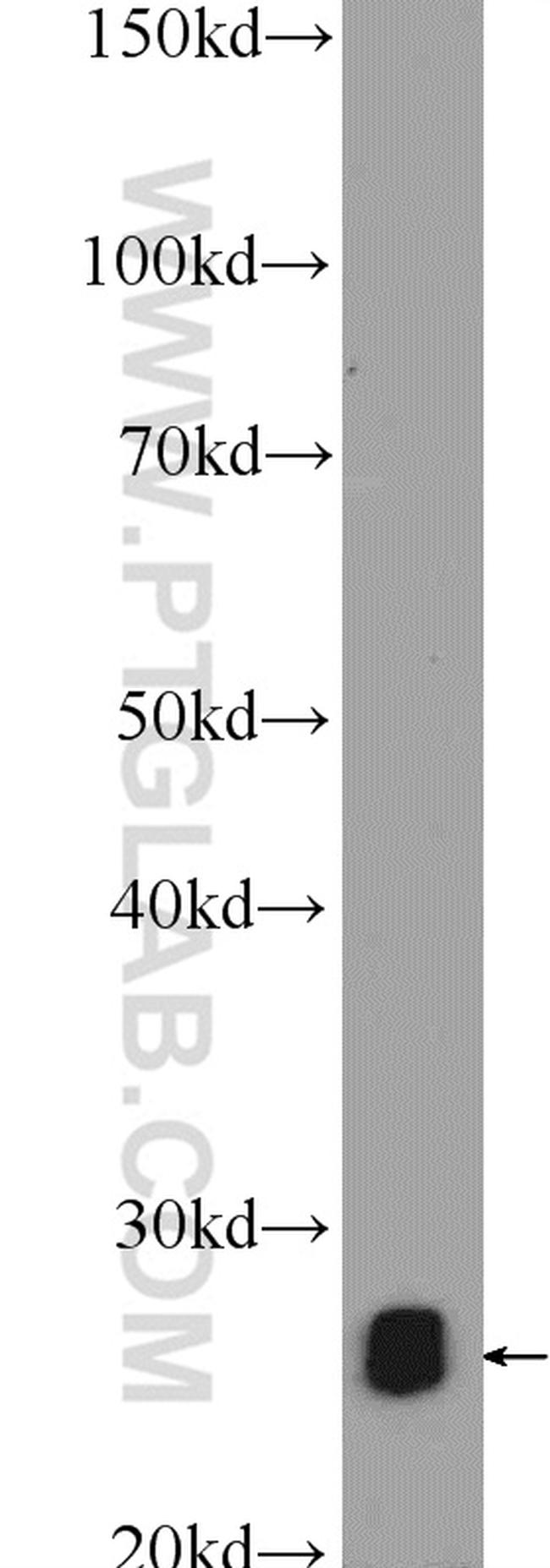 TPI1 Antibody in Western Blot (WB)