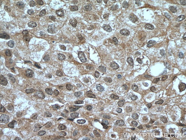 HINT1 Antibody in Immunohistochemistry (Paraffin) (IHC (P))