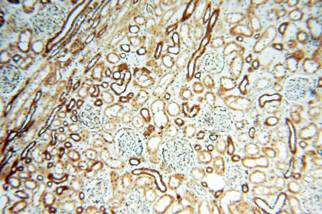 Cyclophilin A Antibody in Immunohistochemistry (Paraffin) (IHC (P))