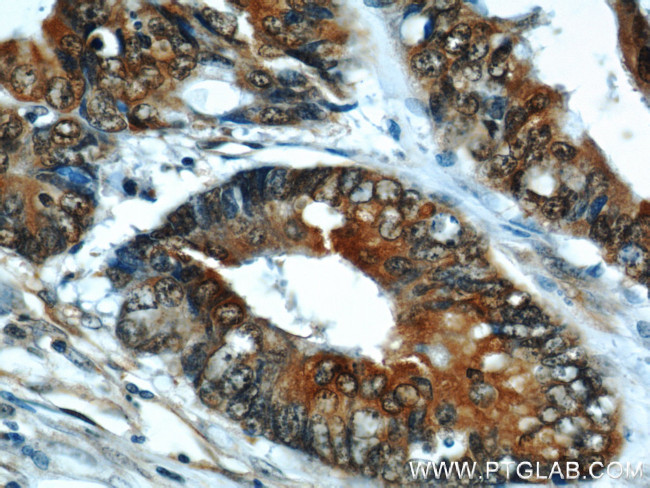 Cyclophilin A Antibody in Immunohistochemistry (Paraffin) (IHC (P))