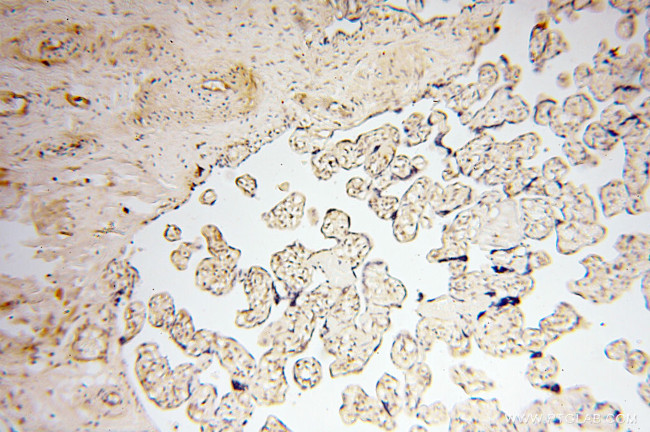 Cyclophilin A Antibody in Immunohistochemistry (Paraffin) (IHC (P))