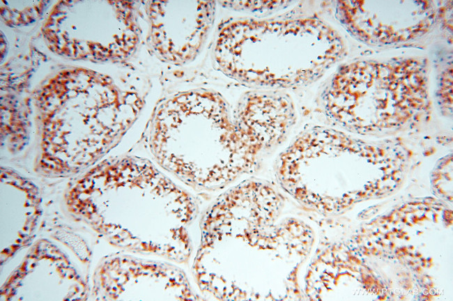 Cyclophilin A Antibody in Immunohistochemistry (Paraffin) (IHC (P))