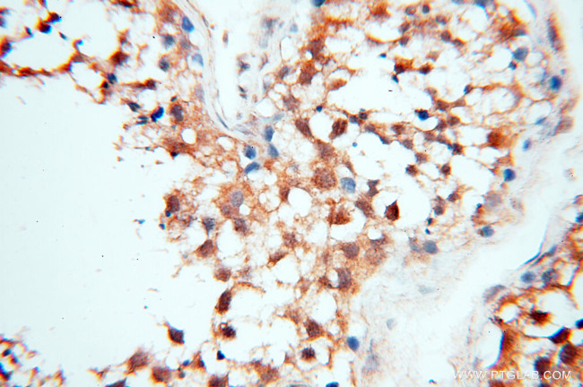 Cyclophilin A Antibody in Immunohistochemistry (Paraffin) (IHC (P))